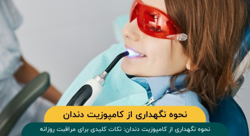 نحوه-نگهداری-از-کامپوزیت-دندان